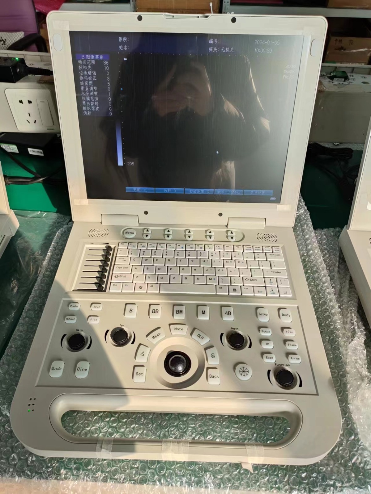 Digital Laptop Ultrasound Diagnostic System